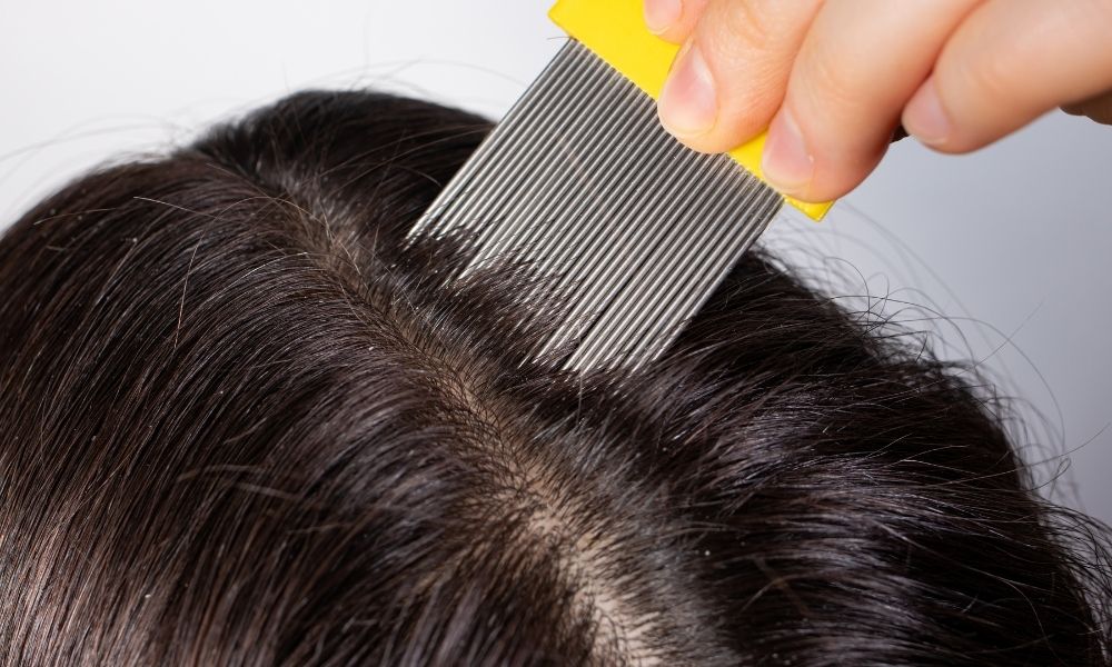 Lược răng khít giúp loại bỏ chấy và trứng chấy bám sát chân tóc hiệu quả